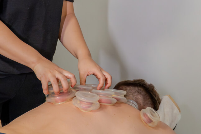 Cupping